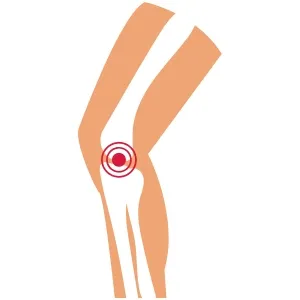 Traumatología en Hermosillo
