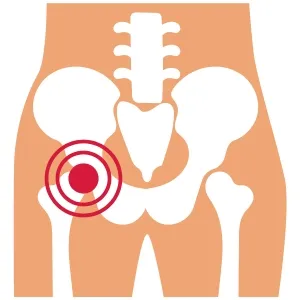 Traumatología en Hermosillo
