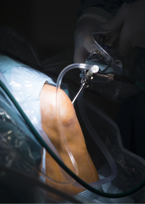 artroscopia dr. francisco figueroa Traumatología en Hermosillo